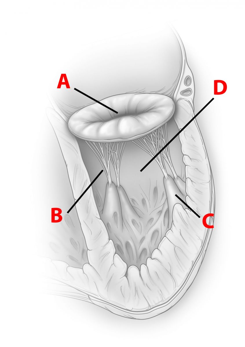 Mitral Valve Prolapse Harvard Health