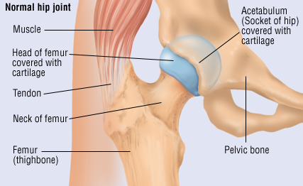 Traumatic Dislocation Of The Hip Harvard Health