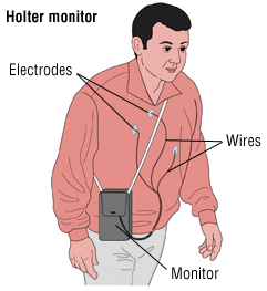 Cardiac Arrhythmias Harvard Health