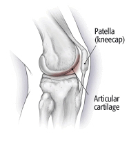 kneecap damage symptoms