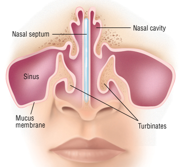 what is nasal