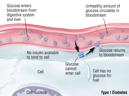 Diabetes Mellitus Overview Harvard Health