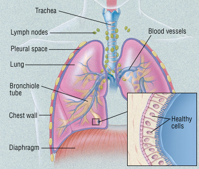 Lung Cancer Overview Harvard Health