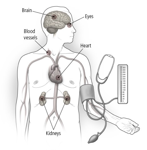 side effects of high blood pressure