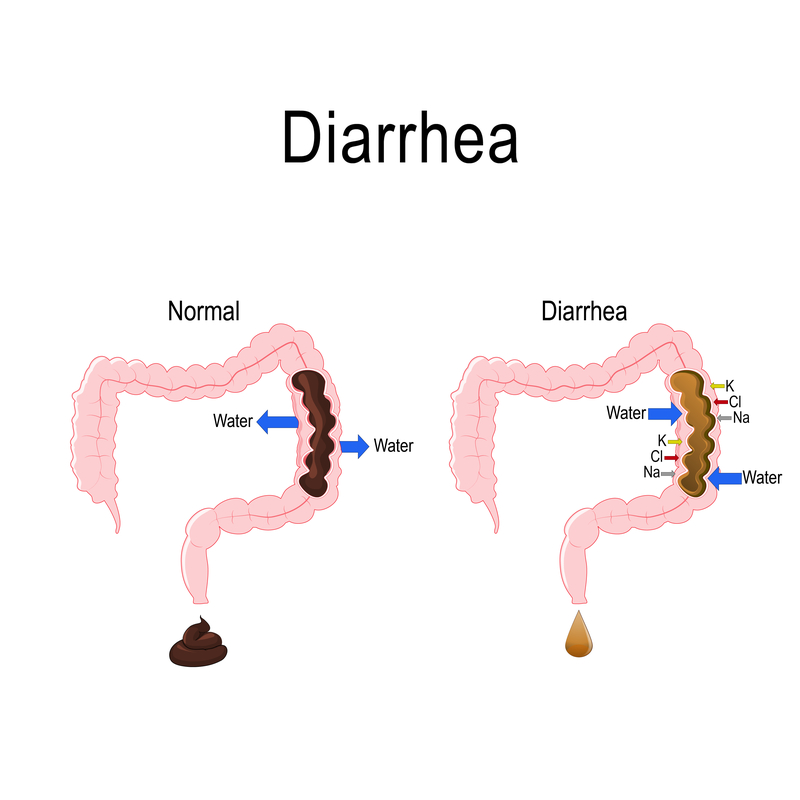 Diarrhea Harvard Health