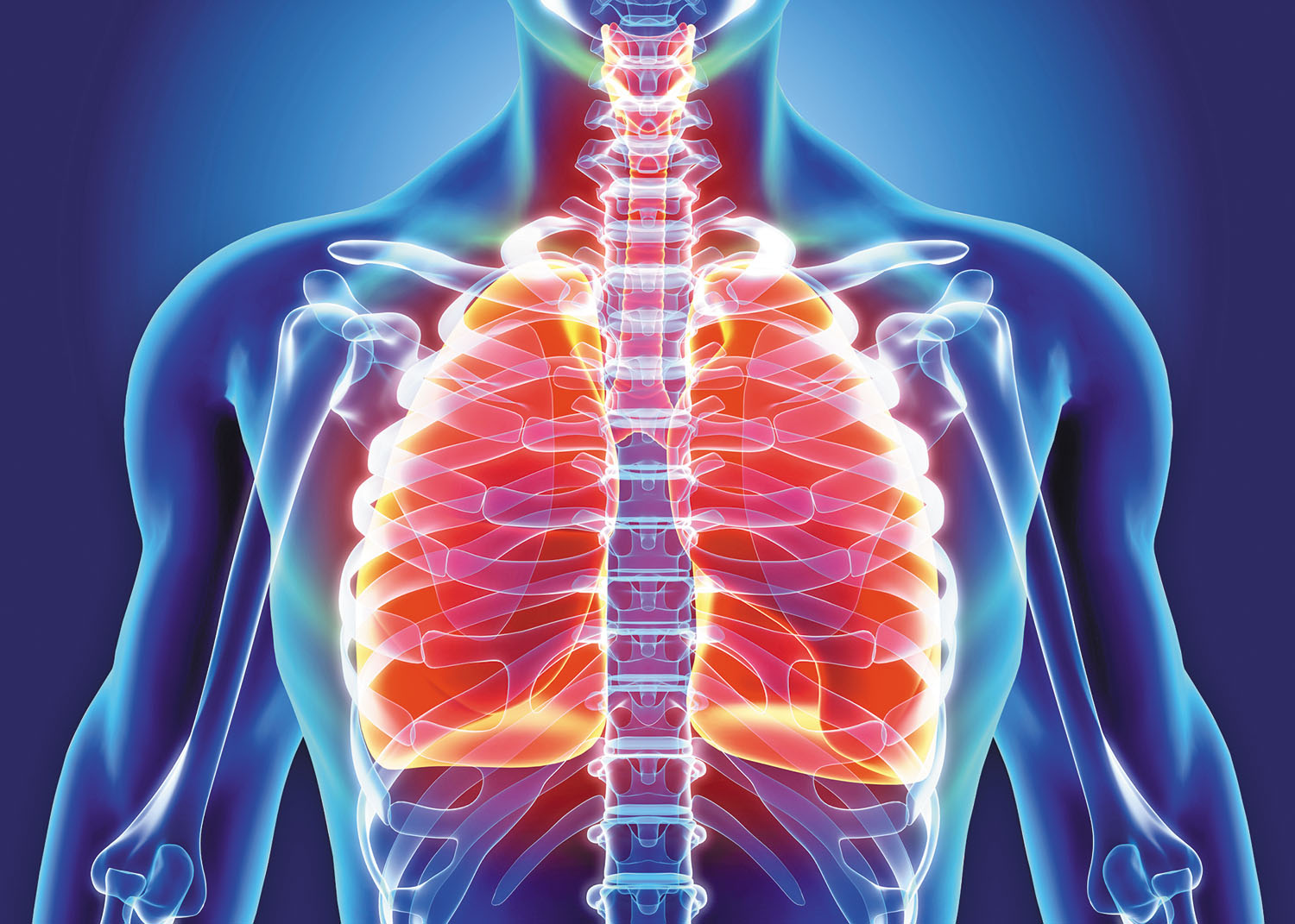 can-bronchitis-lead-to-lung-cancer-cancerwalls