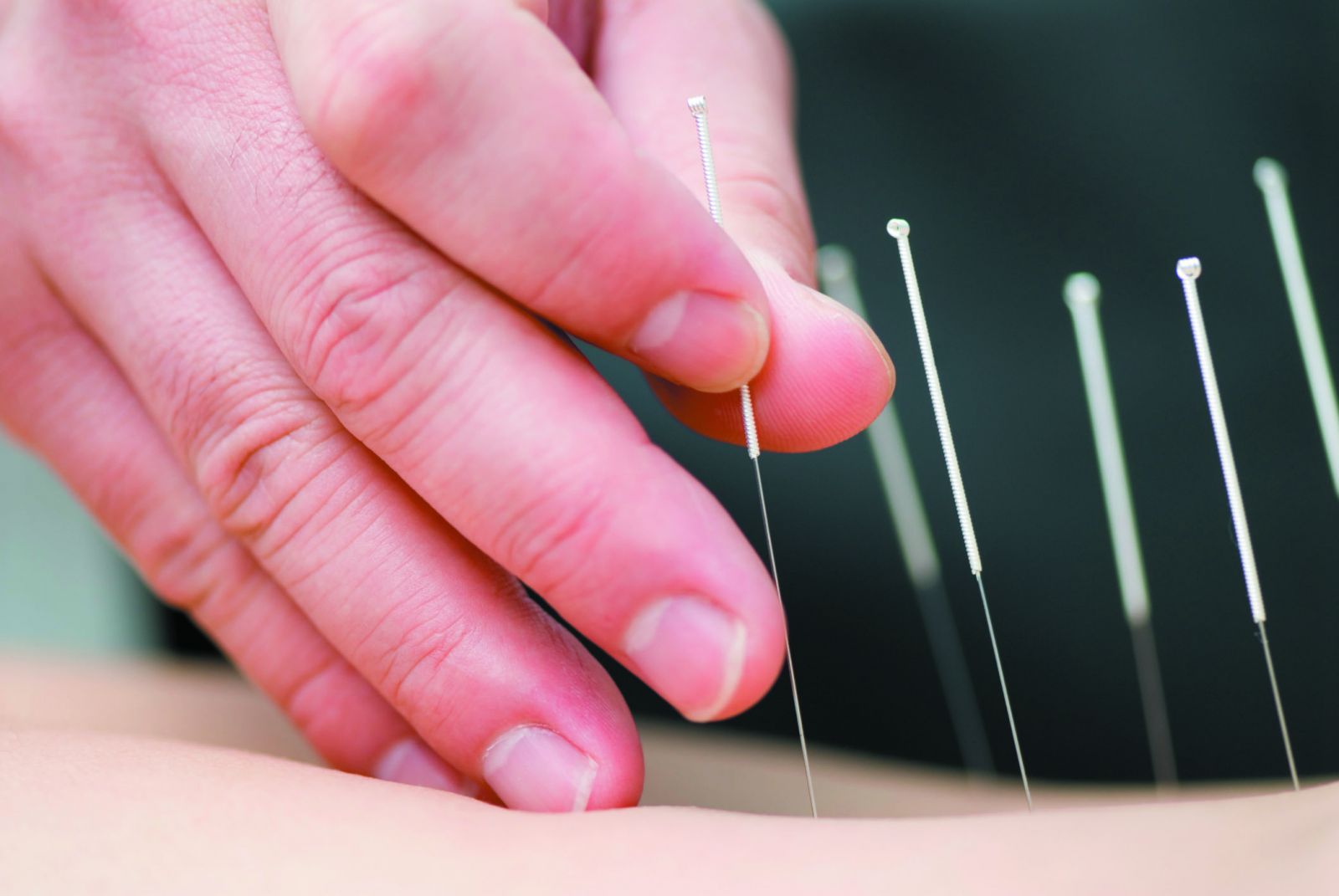 Contemporary Medical Acupuncture Certification Dr