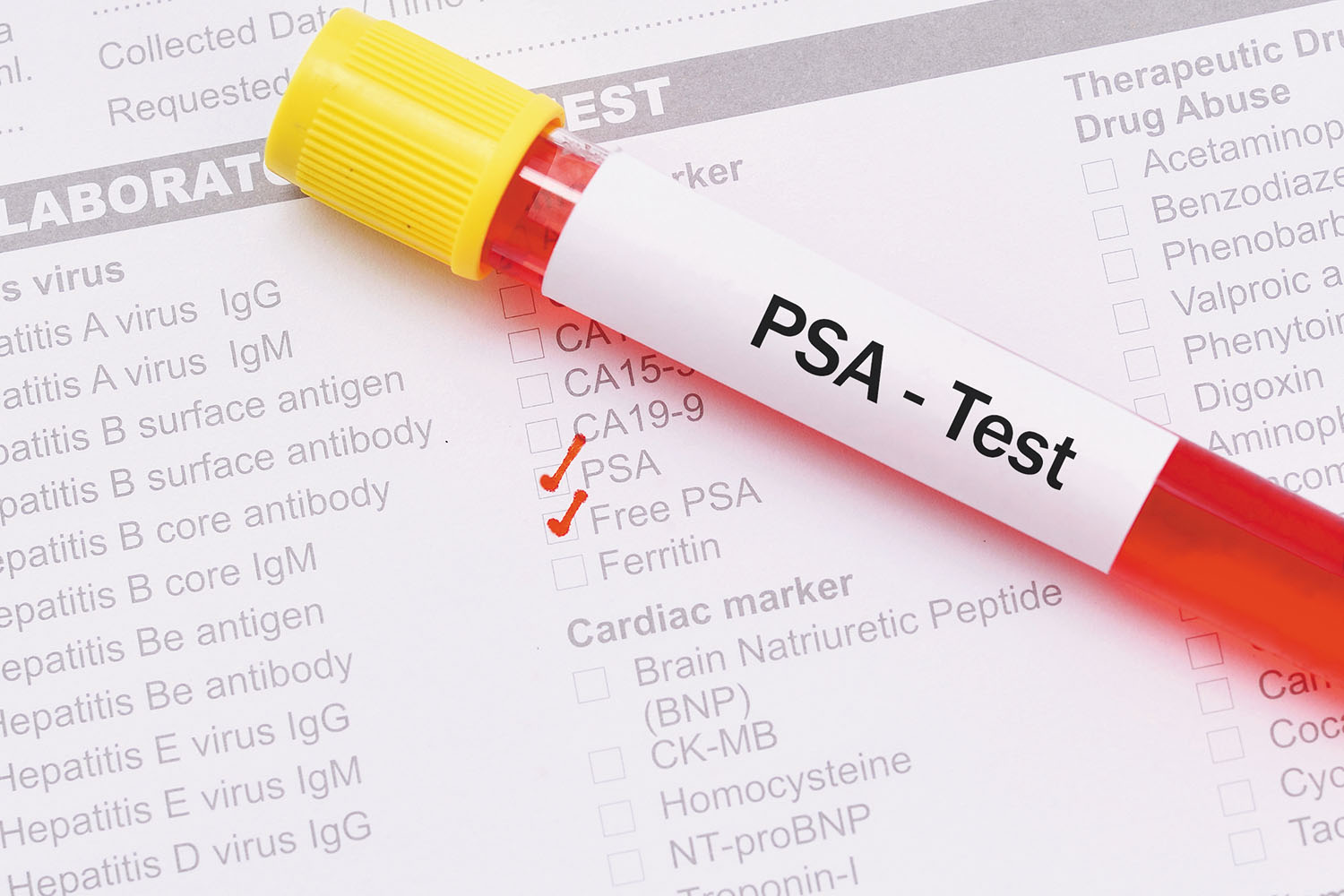 Prostate Screening Guideline Highlights Patient Choice Harvard Health 4642