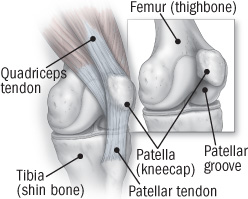 pain in kneecap